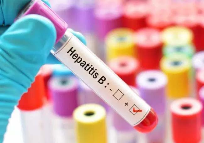 Carta al editor: Importancia de la detección universal de la infección por hepatitis B crónica en adultos en los Estados Unidos