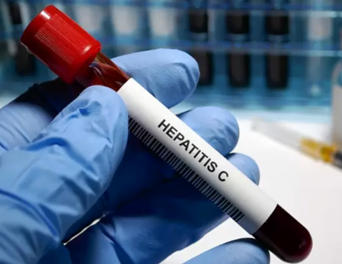 Egipto, el primer país en lograr la validación de la OMS en camino para eliminar hepatitis C
