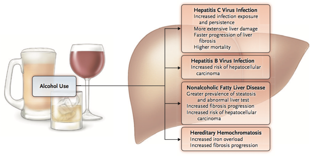Ante el aumento de la enfermedad hepática relacionada con el alcohol es hora de actuar