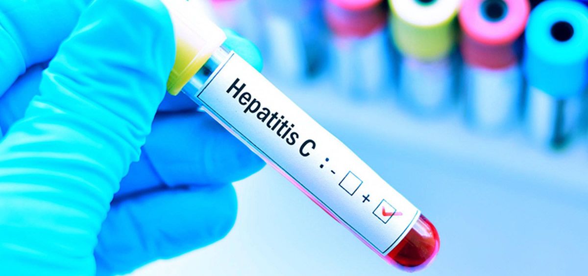 España fue el segundo país europeo que mayor número de casos de hepatitis C registró en 2021