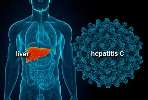 Impacto favorable de los antivirales de acción directa en la mortalidad por hepatitis C tras disponer de su acceso gratuito en España