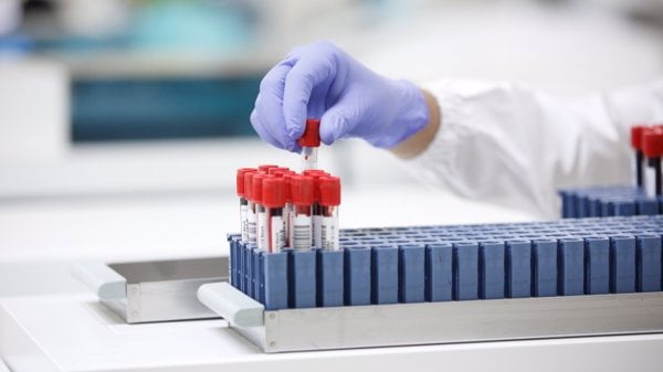 Descubren una firma genética específica de microARN que define la coinfección por hepatitis C y VIH en biopsia líquida