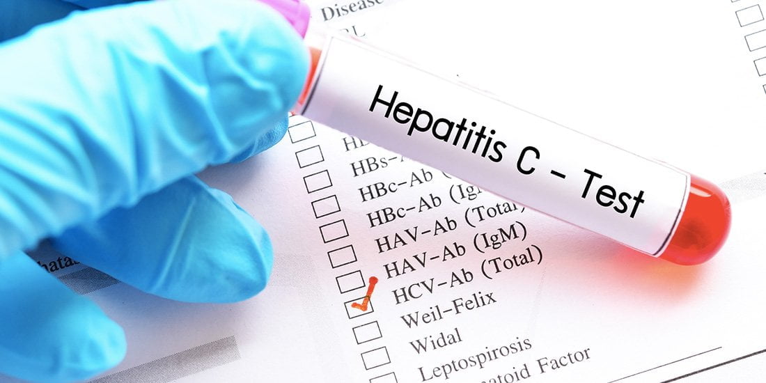 Destacat avenç en l’eliminació de l’hepatitis C en poblacions vulnerables