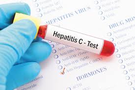 Avaluació de la relació de cost-efectivitat de les estratègies de detecció d’hepatitis C a França