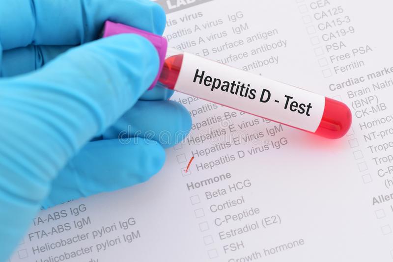 Información importante sobre el virus de la hepatitis D (VHD) o Hepatitis Delta