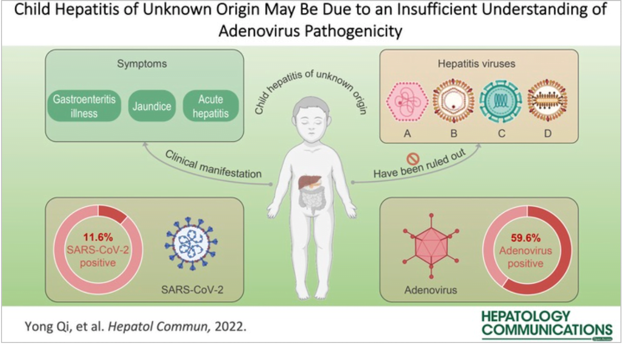 Nueva interpretación de posibles causas de la hepatitis aguda infantil de origen desconocido que creó una alarma hace 2 años